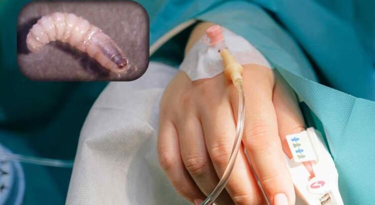 Chiapas alcanza 75 casos de miasis en humanos por gusano barrenador